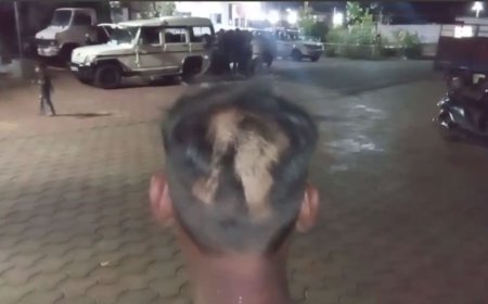 Jabalpur News : मां की दवाई लेने निकला युवक के साथ बेरहमी से मारपीट, सिर के बाल भी काटे! पुलिस ने की जाँच शुरू