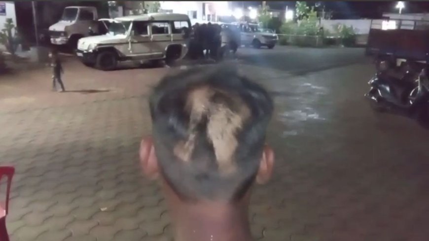Jabalpur News : मां की दवाई लेने निकला युवक के साथ बेरहमी से मारपीट, सिर के बाल भी काटे! पुलिस ने की जाँच शुरू